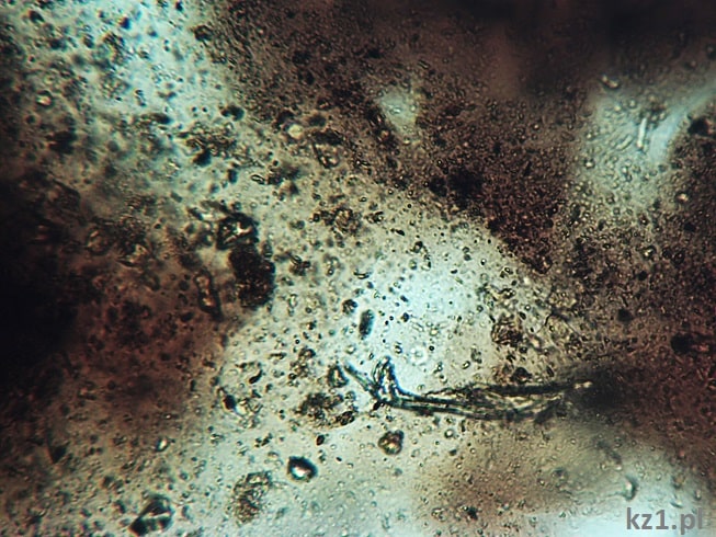 mikoryza mikroskop