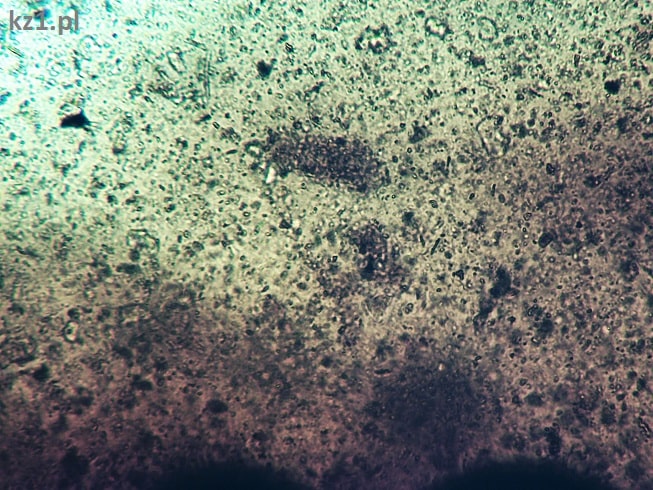 mikoryza w zbliżeniu
